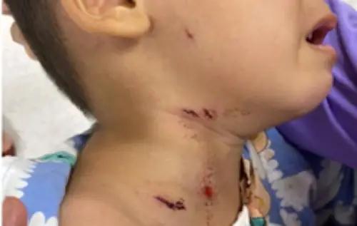 Ảnh Đàn Chó Đang Ăn