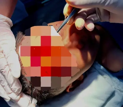 Bé 7 Tuổi Bị Chó Cắn: Dấu Hiệu, Xử Trí Và Phòng Ngừa Bệnh Dại