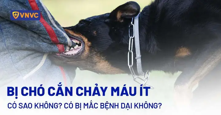 Bị Chó Cắn Chảy Máu Ít Có Sao Không