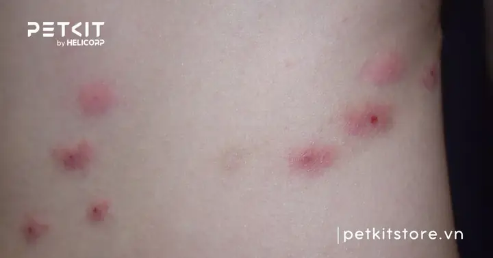 Người Bị Mèo Dại Cắn Bao Lâu Thì Phát Bệnh? Người Bị Mèo Dại Cắn Bao Lâu Thì Phát Bệnh?