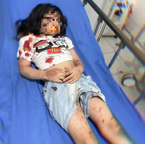 Đánh Chết Chó Thả Rông Cắn Người Có Phải Bồi Thường?- Ảnh 1.