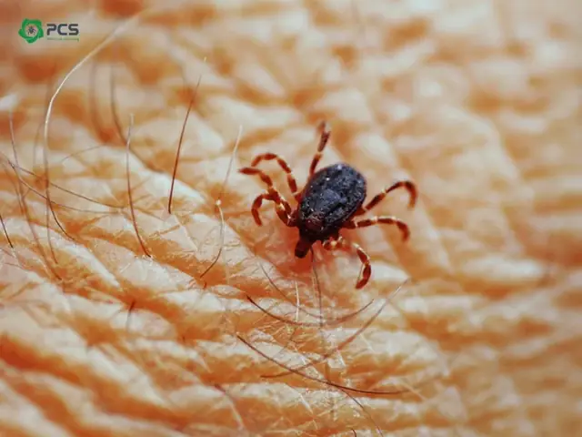 Vì Sao Cần Phải Diệt Bọ Chét?