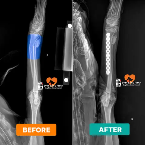 Cần Chuẩn Bị Gì Khi Đến Bệnh Viện Và Tìm Nguồn Hỗ Trợ Uy Tín Cần Chuẩn Bị Gì Khi Đến Bệnh Viện Và Tìm Nguồn Hỗ Trợ Uy Tín