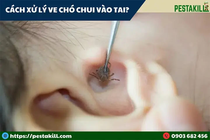 Cách Xử Lý Khi Bị Ve Chó Chui Vào Tai Cách Xử Lý Khi Bị Ve Chó Chui Vào Tai