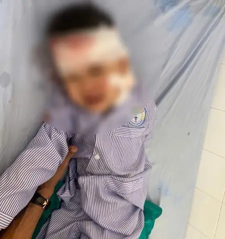 Cháu Bé Bị Chó Cắn