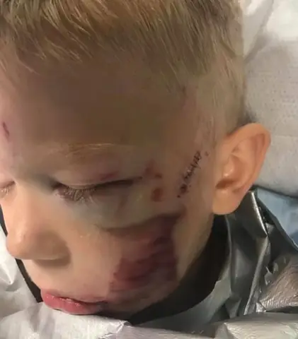 Câu Chuyện Của Bé Trai 6 Tuổi Bridger Walker Nhận Được Nhiều Sự Quan Tâm Của Dân Mạng. Câu Chuyện Của Bé Trai 6 Tuổi Bridger Walker Nhận Được Nhiều Sự Quan Tâm Của Dân Mạng.