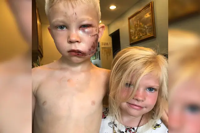 Câu Chuyện Của Bé Trai 6 Tuổi Bridger Walker Nhận Được Nhiều Sự Quan Tâm Của Dân Mạng.