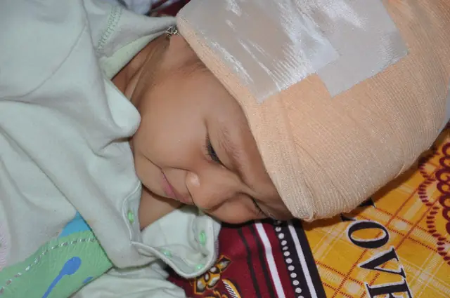 Đang Sang Nhà Hàng Xóm Chơi, Bé Na Bị Chó Cắn Làm Rách Toàn Bộ Vùng Da Đầu Khiến Máu Chảy Dầm Dề Buộc Em Phải Nhập Viện Trong Tình Trạng Khẩn Cấp. Việc Điều Trị Của Con Kéo Dài, Lại Tốn Kém Khiến Bố Mẹ Đứng Ngồi Không Yên Khi Mới Chỉ Đi Vay Được Vỏn Ven Mấy Triệu Đồng.