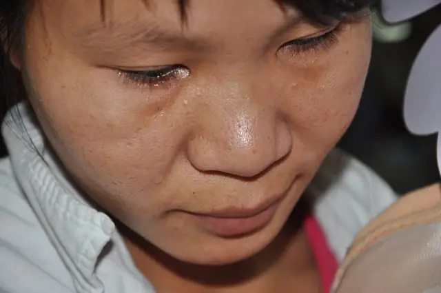 Đang Sang Nhà Hàng Xóm Chơi, Bé Na Bị Chó Cắn Làm Rách Toàn Bộ Vùng Da Đầu Khiến Máu Chảy Dầm Dề Buộc Em Phải Nhập Viện Trong Tình Trạng Khẩn Cấp. Việc Điều Trị Của Con Kéo Dài, Lại Tốn Kém Khiến Bố Mẹ Đứng Ngồi Không Yên Khi Mới Chỉ Đi Vay Được Vỏn Ven Mấy Triệu Đồng.