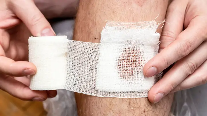 Sơ Cứu Khi Bị Chó Cắn