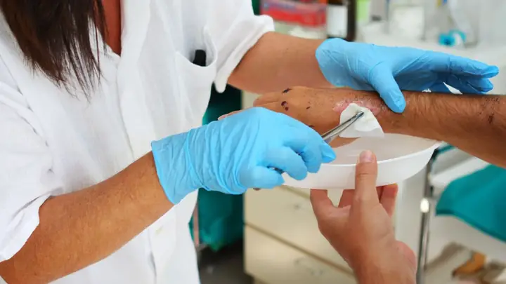 Vết Thương Nhỏ Hóa Nhiễm Trùng Có Phải Do Đắp Lá Cây?