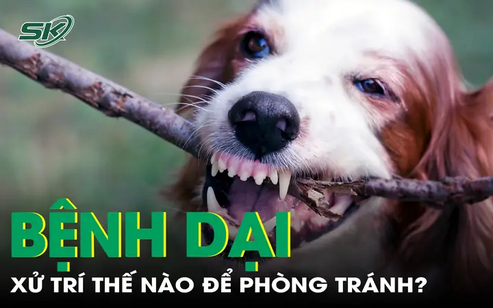 Cách Xử Trí Vết Thương Để Tránh Bệnh Dại Khi Bị Chó Mèo Cắn