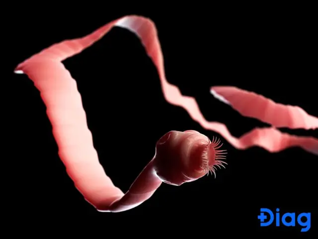 Sán Lợn Chết Ở Nhiệt Độ Bao Nhiêu?