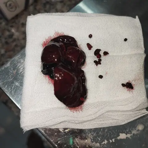 Chó Bị Nổi Cục U Ở Cổ Và Cách Chữa Trị Chó Bị Nổi Cục U Ở Cổ Và Cách Chữa Trị