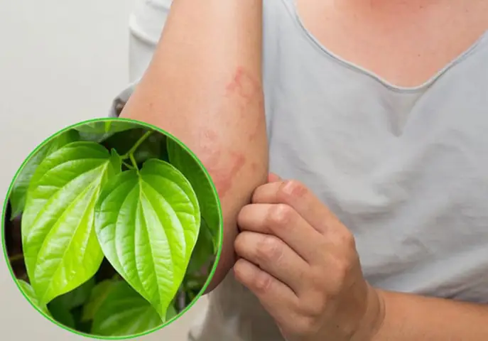 Hướng Dẫn Cách Trị Ghẻ Bằng Lá Trầu Không Nhanh Khỏi