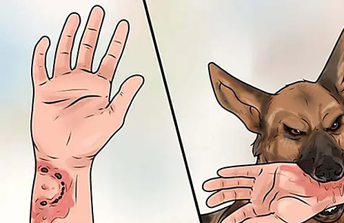 Đầu Năm Bị Chó Cắn: Làm Gì Để Xử Lý Kịp Thời Và Phòng Tránh Hiệu Quả?