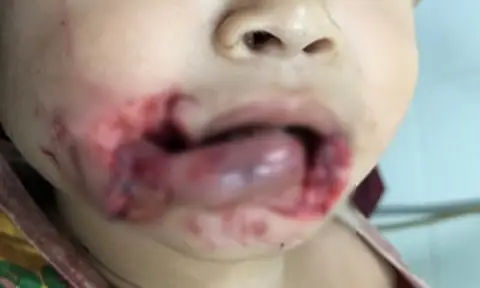 Đầu Tháng Bị Chó Cắn Có Sao Không? Hướng Dẫn Xử Lý Và Phòng Ngừa Hiệu Quả