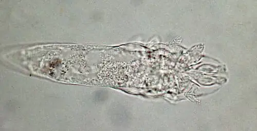 Vậy Từ Người Qua Người Thì Demodex Có Lấy Không?