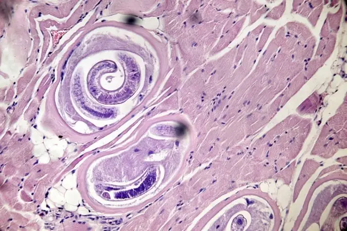 Tại Sao Nó Lại Nguy Hiểm?