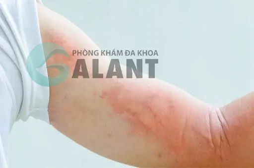 Tôi Có Thể Bị Nhiễm Sán Dây Khi Tiếp Xúc Với Chó Và Mèo Không? Tôi Có Thể Bị Nhiễm Sán Dây Khi Tiếp Xúc Với Chó Và Mèo Không?