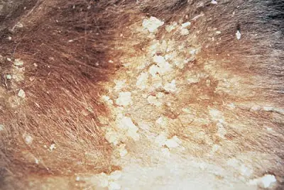 Biểu Hiện Bệnh Nấm Da Trên Chó