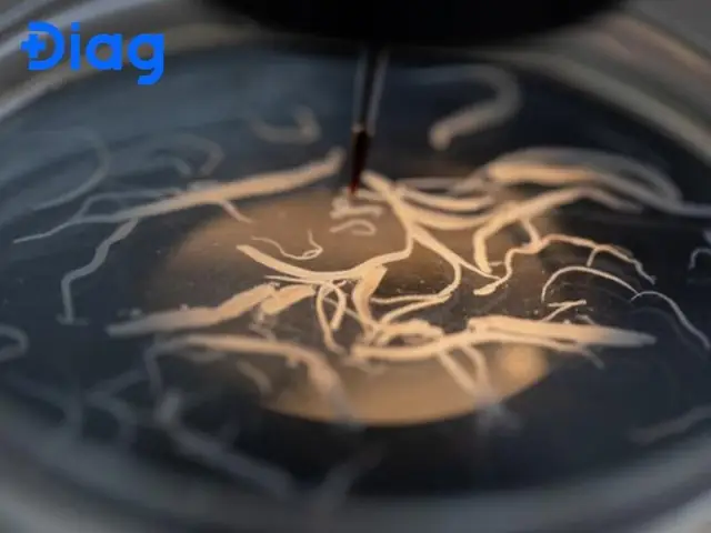 Sán Xơ Mít Là Gì?