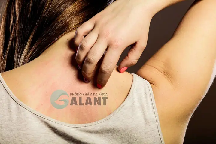 Tiêm Ngừa Giun Sán Cho Chó