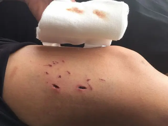 Cách Phòng Ngừa Chó Cắn Cách Phòng Ngừa Chó Cắn