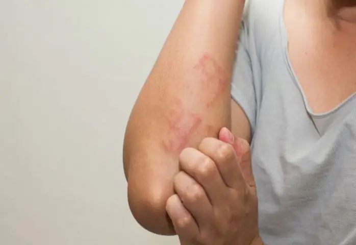 Khi Nào Nên Thực Hiện Xét Nghiệm Sán Chó?