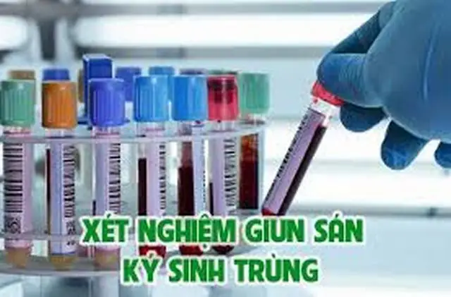 Xét Nghiệm Máu Nhiễm Giun Sán