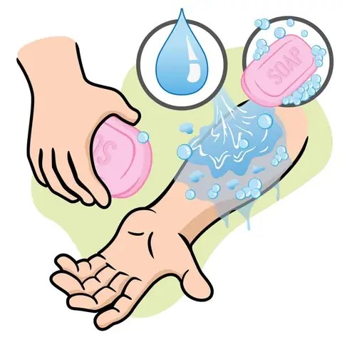 Sơ Cứu Khi Bị Chó Cắn Chảy Máu