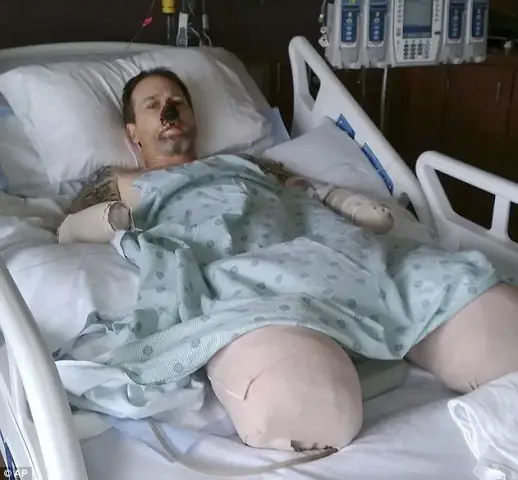 Khuyen-cao-dung-vi-yeu-cho-ma-de-cho-liem-mat-keo-ruoc-benh-vao-nguoi-nhu-nguoi-dan-ong-nay-voh-2