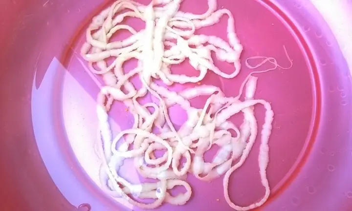 Sán Xơ Mít (cestoda)