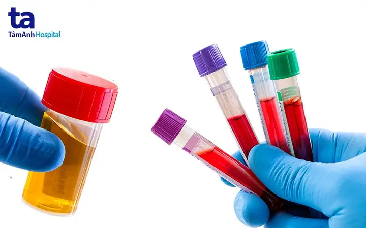 U Bướu Thận U Bướu Thận