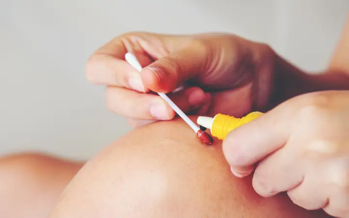 Trường Hợp Không Cần Tiêm Phòng