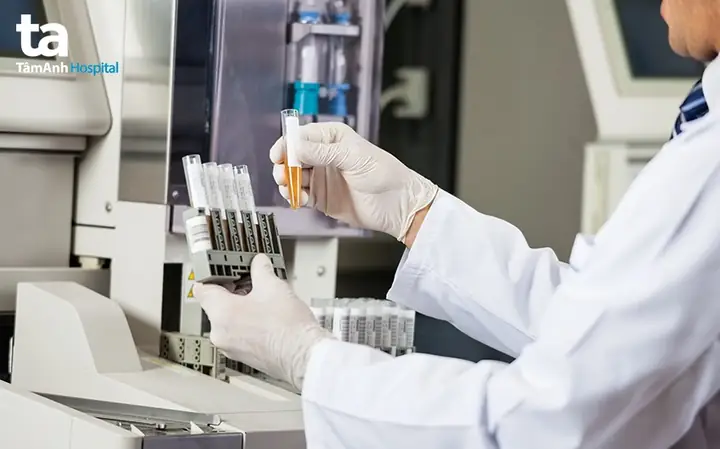 Chẩn Đoán Bệnh Tiểu Ra Máu Như Thế Nào?