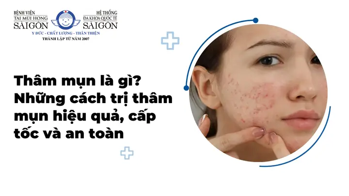 Trị Thâm Mụn Trị Thâm Mụn