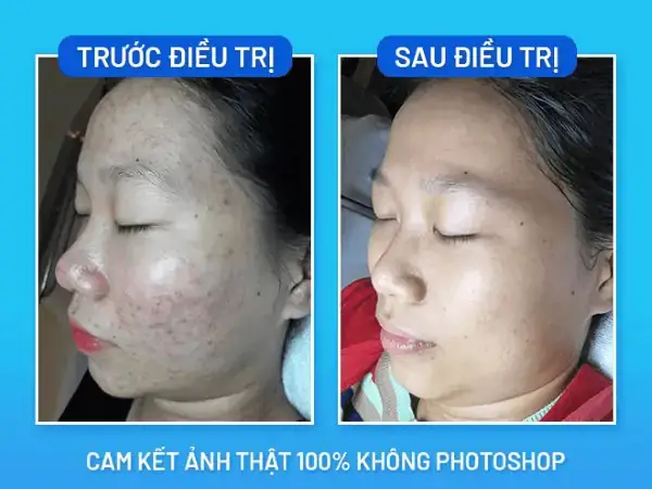 Tổng Kết Và Khuyến Nghị