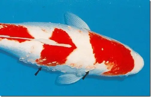 Khái Quát Về Bệnh: