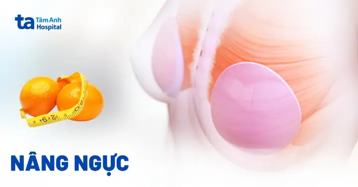 Phẫu Thuật Nâng Ngực: Chỉ Định, Quy Trình Thực Hiện Và Các Thắc Mắc