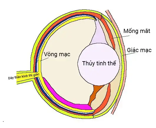 Dấu Hiệu Nhận Biết Cá Tai Tượng Bị Đục Mắt