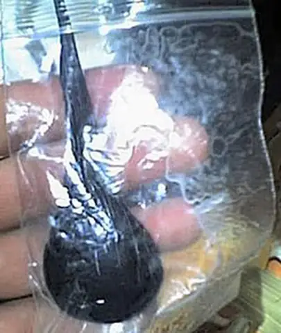 Cá Trắm Và Ngộ Độc Mật Cá Trắm