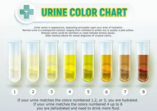 Các Yếu Tố Ảnh Hưởng Đến Màu Sắc Nước Tiểu