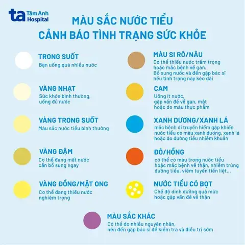 Các Yếu Tố Chính Ảnh Hưởng Đến Màu Sắc