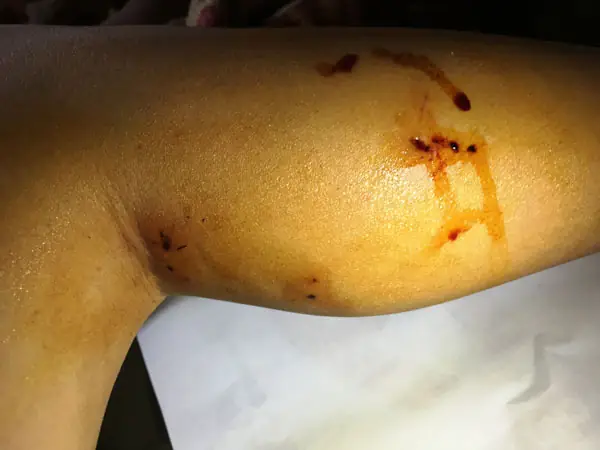 Cách Trị Chó Cắn Dân Gian