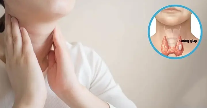 Low Iodine Diet Menu: Thực Đơn 10 Ngày Cho Điều Trị I-131