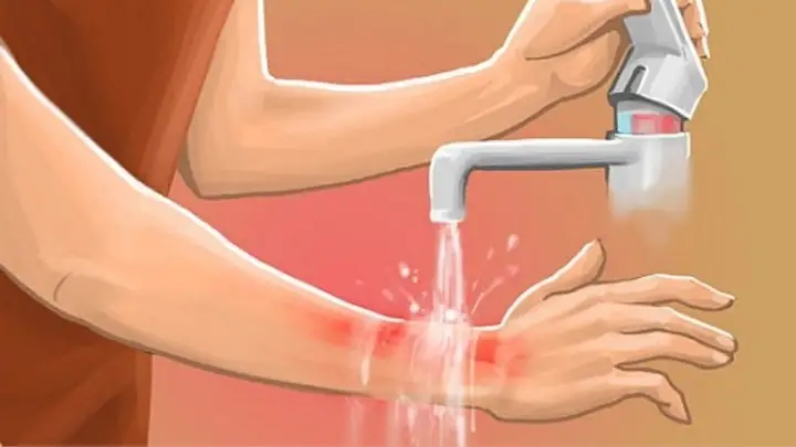 Xử Lý Vết Thương