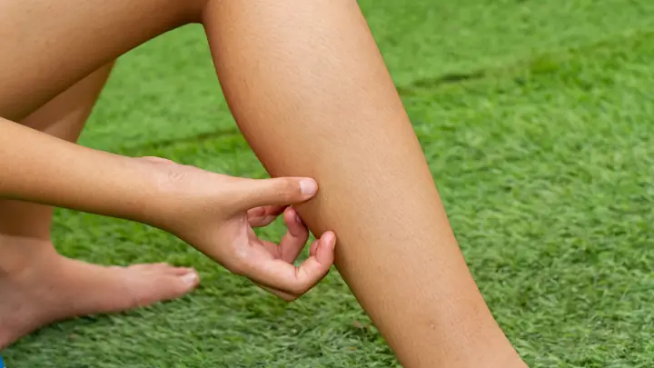 Bị Chó Cắn Xước Nhẹ Ở Chân Có Sao Không? Bị Chó Cắn Xước Nhẹ Ở Chân Có Sao Không?