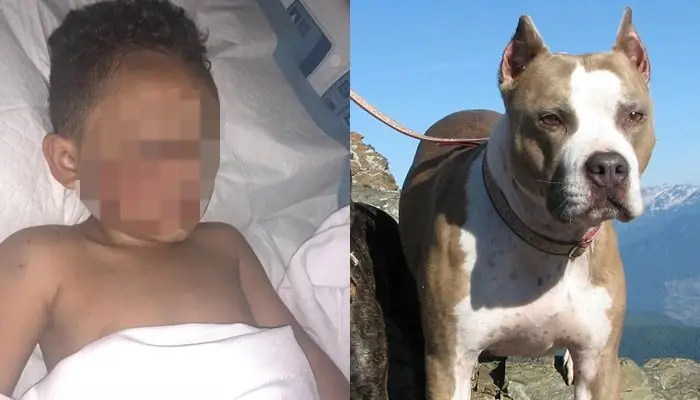 Chó Pitbull Tấn Công Người: Nguyên Nhân, Dấu Hiệu Nhận Biết Và Cách Phòng Tránh Chó Pitbull Tấn Công Người: Nguyên Nhân, Dấu Hiệu Nhận Biết Và Cách Phòng Tránh