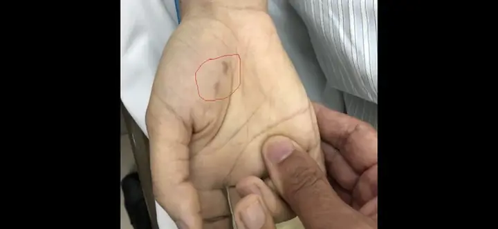 Bị Chó Dại Cắn Trong Lúc Chữa Bệnh, Nữ Bác Sĩ Thú Y Trẻ Tử Vong - Ảnh 1.